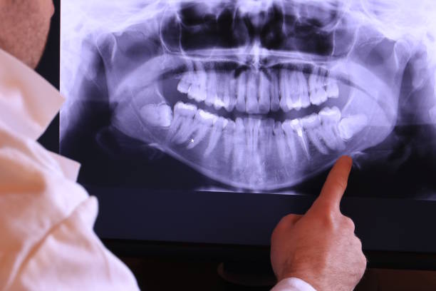 Best Emergency Dental Care for Sports Injuries in Wilmington Manor, DE